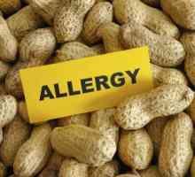 Come sapere se il mio bambino è allergico al burro di arachidi